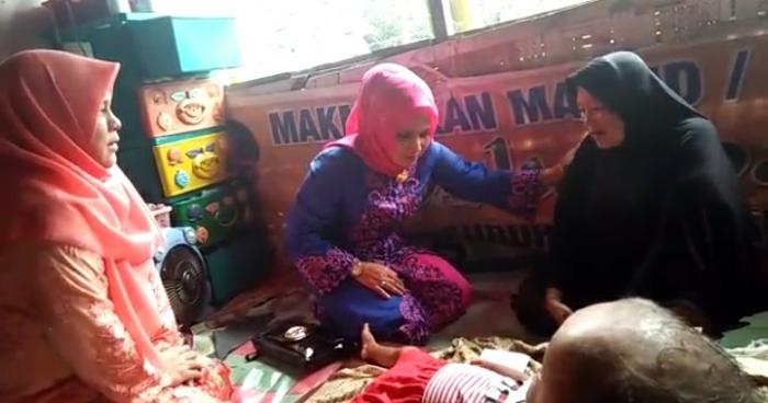 Bupati Labuhanbatu Jenguk Balita Penderita Hydrocepalus