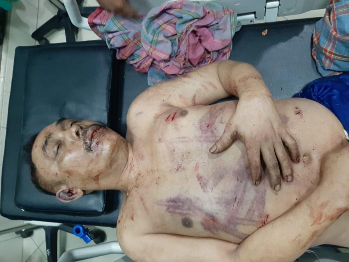 Istri Siksa Suami Penderita Stroke 