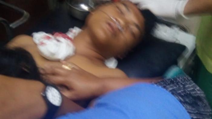 Jalan Tritura Medan Rawan Kriminalitas, Pengendara Kritis Dihantam Batu 