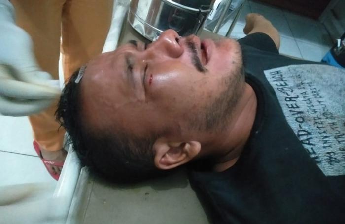 Sopar Sinambela Dipukuli di Kafe 