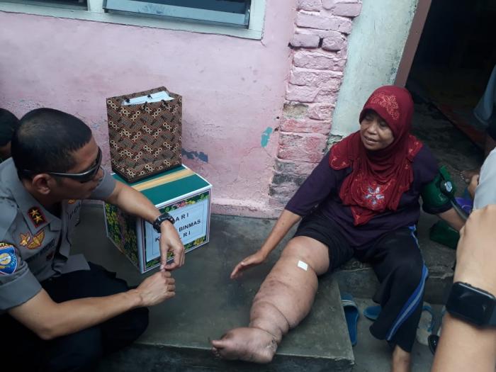 Mabes Polri dan Polda Sumut Gelar Bakti Sosial 