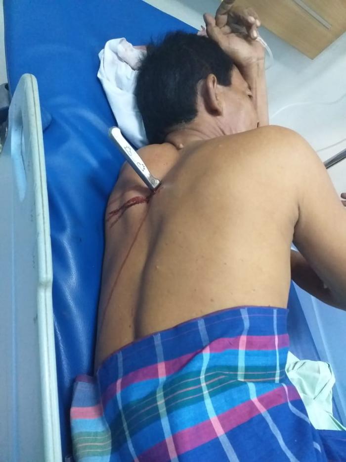Diduga Selingkuhi Istri Orang, Parbetor Kritis Ditikam 