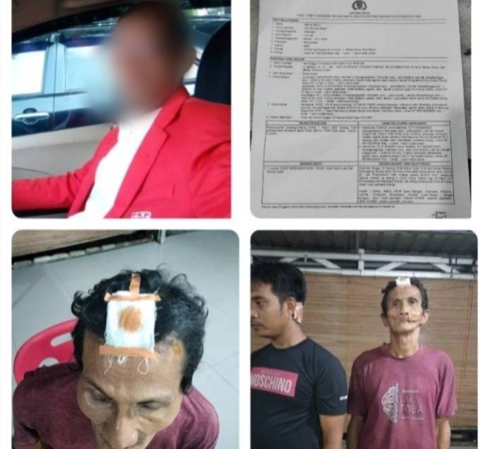 Ngaku Tokoh Pemuda Sumut "Acil Cs" Aniaya Warga & Kakek-Kakek Berbuntut Dilaporkan.