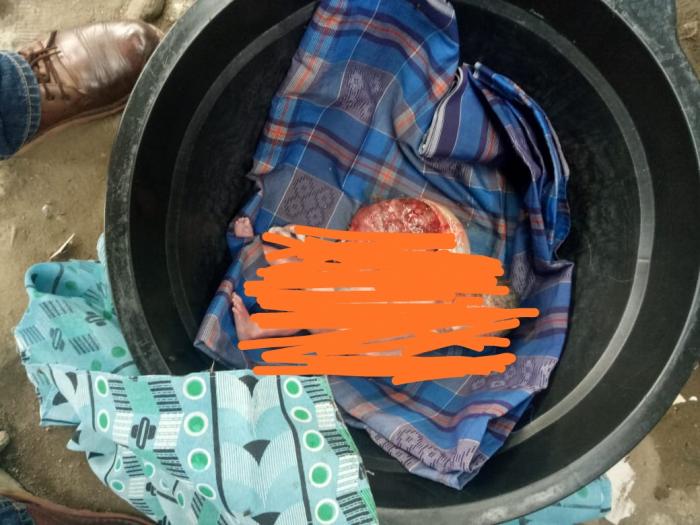Mayat Bayi Perempuan Dibuang di Parit 