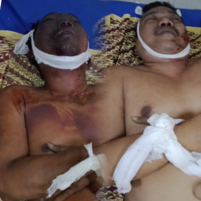 DPRD Sumut Minta Usut Tuntas Kecelakaan Kerja di PT Kedaung yang Renggut 2 Nyawa