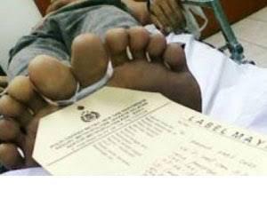 Gepeng Tewas Ditemukan di Jalan AH Nasution 