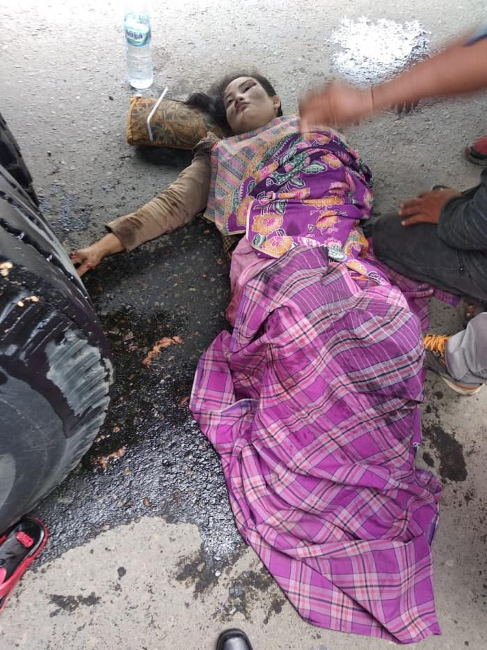 Masuk Kolong Truk, Kaki Kanan Maya Nofita Sari Hancur Terlindas 