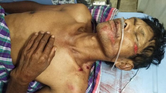 Polisi Ditikam, 2 Butir Peluru Bersarang 