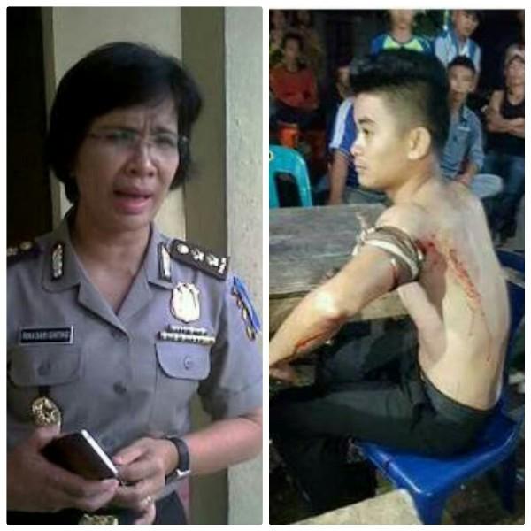 Poldasu" Kasus Penyerangan Bripda Julius Masih Lidik " 