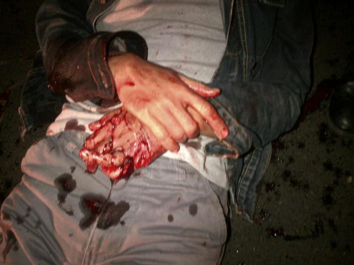 Usai Antar Kakak Ipar, Jari Tangan Taufik Putus Ditebas Begal  