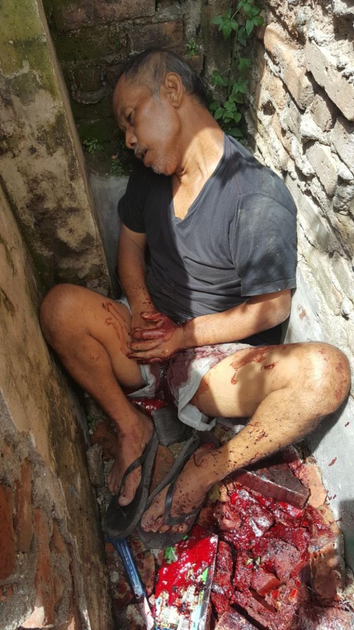 Diduga Stres, Sahala Hutabarat Mati Potong Urat Nadi Sendiri