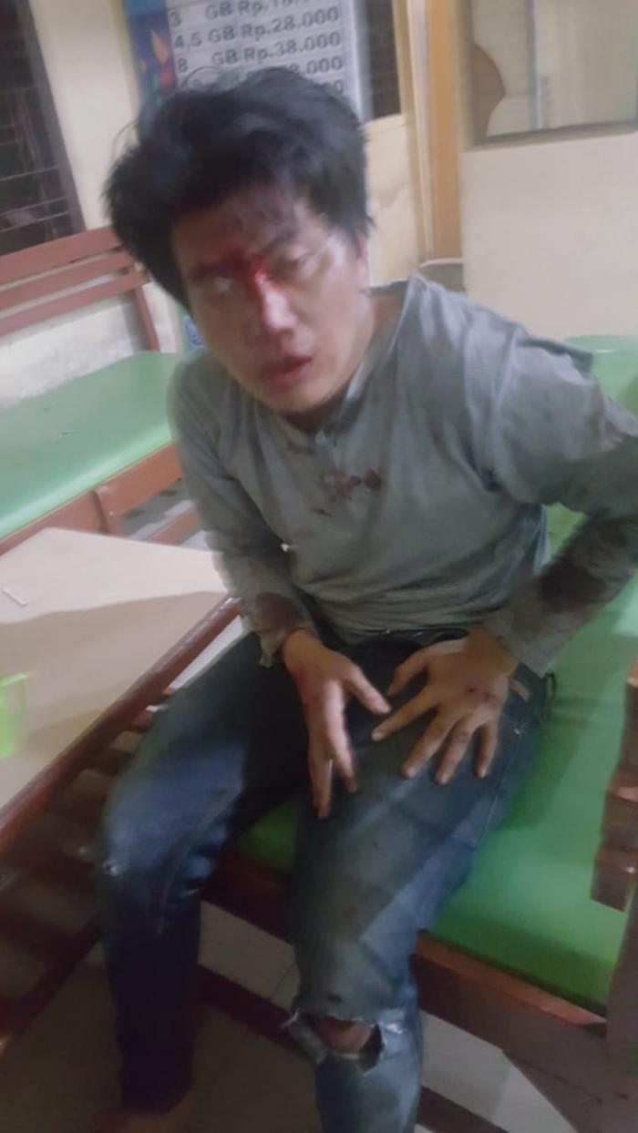 Penjambret Nyaris Tewas Dihajar Massa