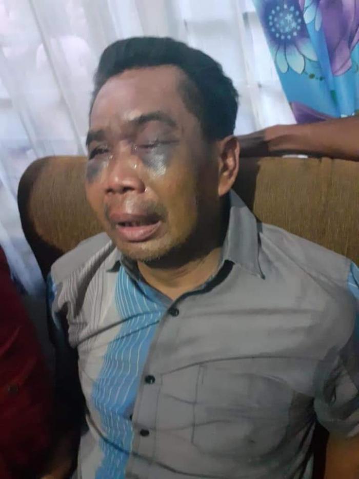 LBH Medan Desak Oknum Polisi Percut Penganiaya Saksi Pembunuhan Diperiksa 