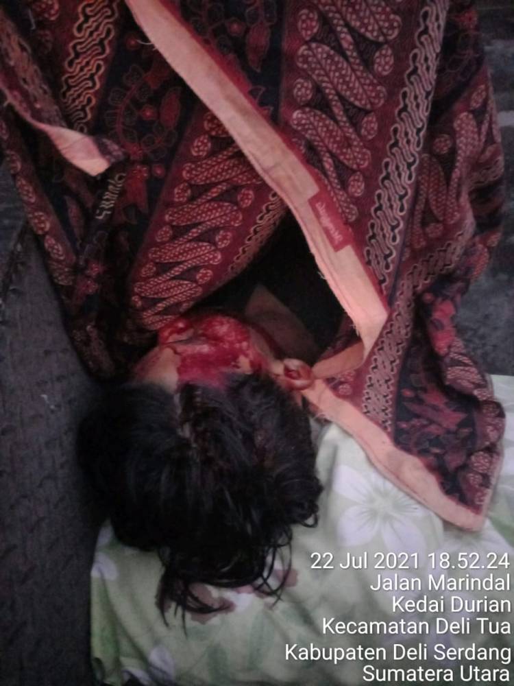 Pemuda Tewas Ditikam di Marindal, Kepala Pecah