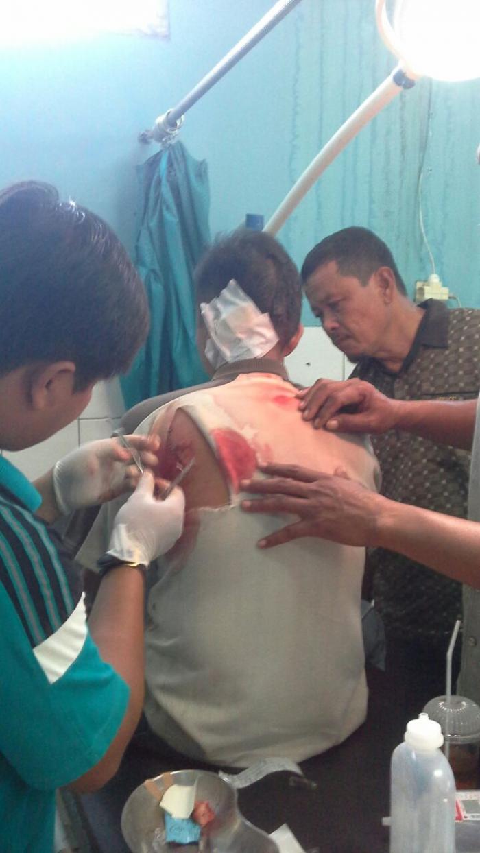 Gara-gara Ditegur, Nelayan Tengik Bacok Teman Pakai Golok