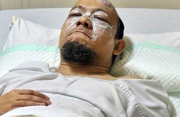 Novel Baswedan soal kondisi matanya saat ini