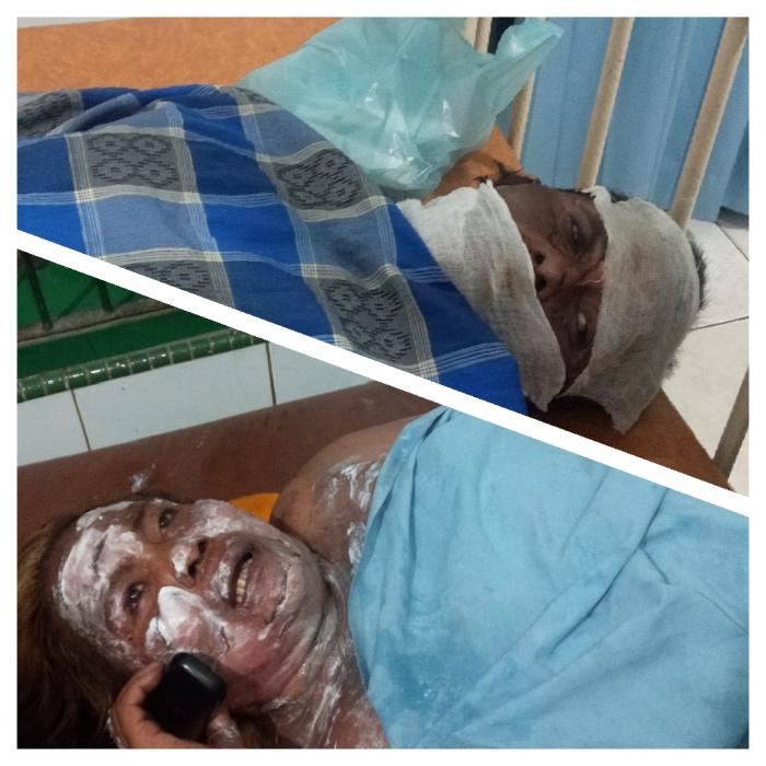 Cekcok Mulut Gegara Lembu, Suami Dibakar Istri Muda 