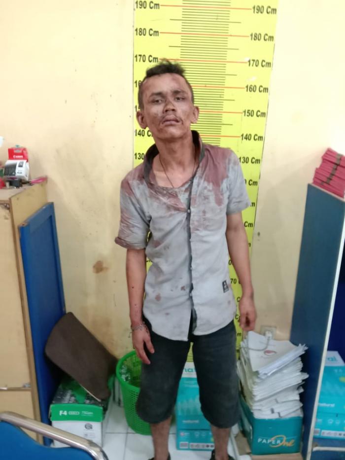 Perampok Nyaris Tewas Diamuk Massa