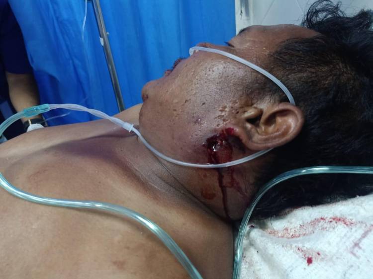 Jukir Penghalau Perampok Emas Terkapar di Rumah Sakit Butuh Biaya