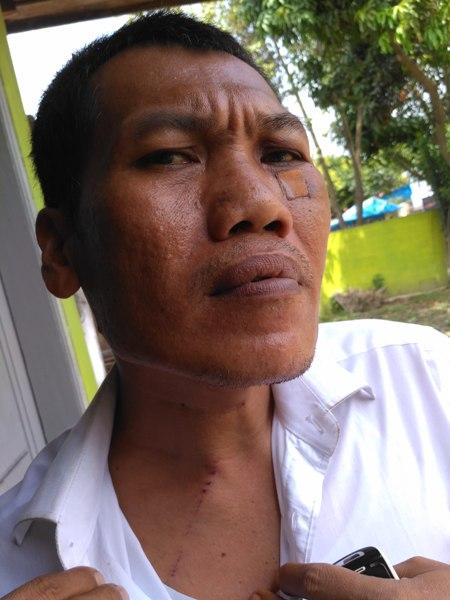 Niat Buka Usaha, Malah Dikeroyok Preman Tengik