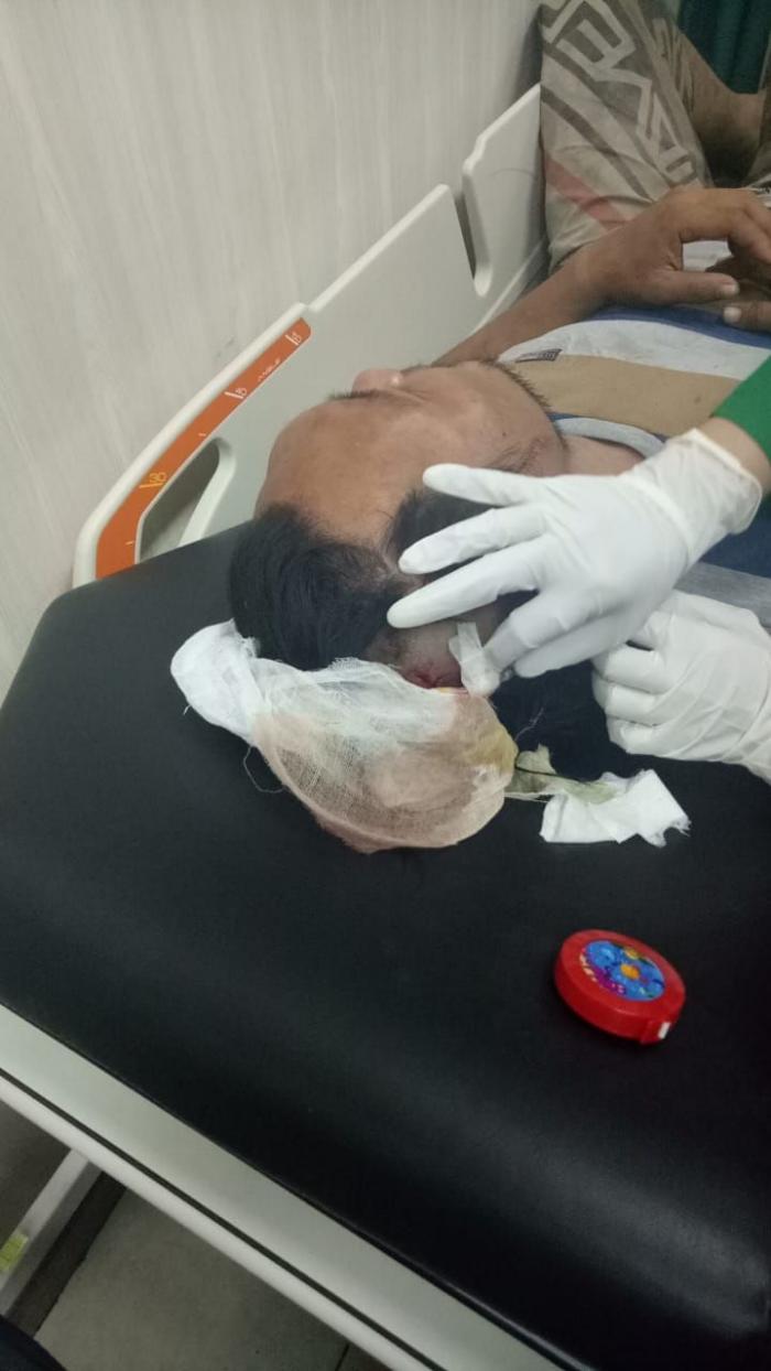 Video Viral di Medsos, Kasus Pengeroyokan Warga Jalan Bakung Atensi Poldasu