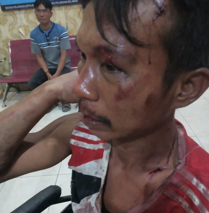 Pengusaha Kota Bangun Diduga Suruh Oknum Tentara Aniaya Warga 