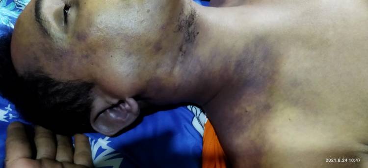 LBH Minta Tahanan Polsek Medan Kota Tewas Diotopsi