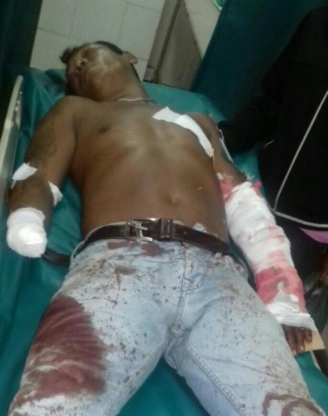 Bentrok Lahan Garapan, Tangan Putus Diklewang