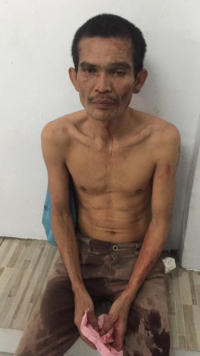 Mencoba Melarikan Diri, Tahanan Ini Bonyok Ditangkap Petugas