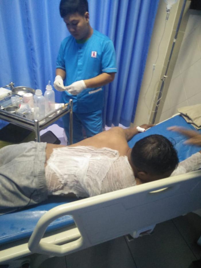 Ruko Bengkel Sepeda Motor Terbakar, Seorang Luka Bakar