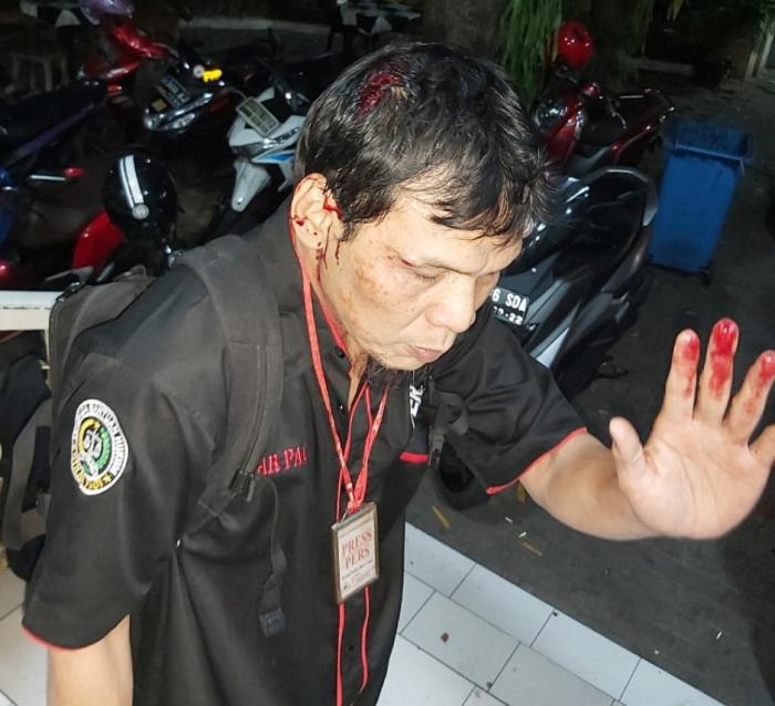 Belasan Oknum Polri Aniaya Wartawan Terjadi di Polda Metro Jaya 