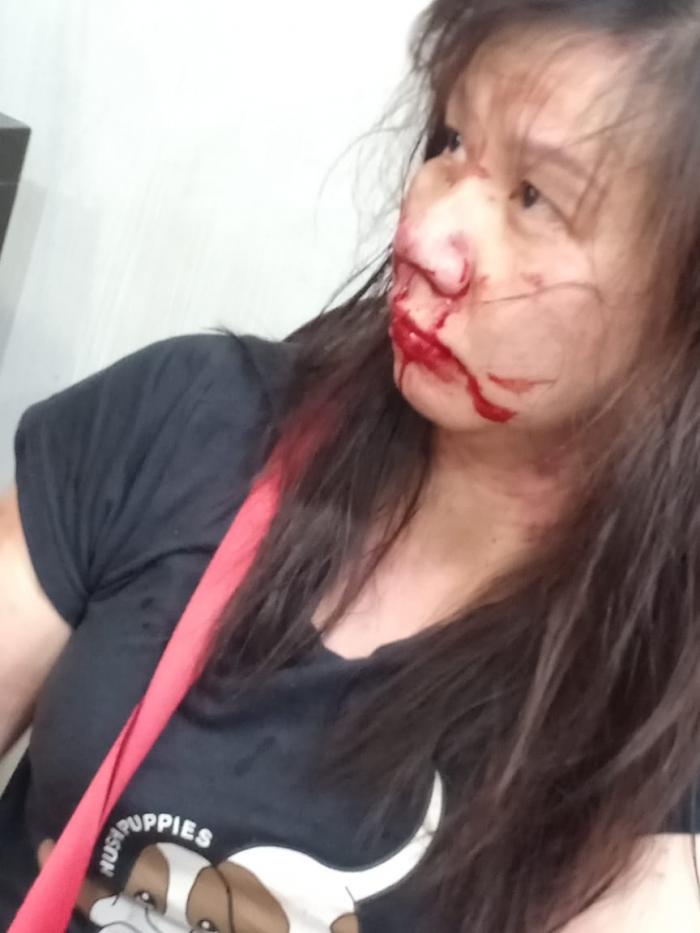 Wanita Tionghoa Berlumuran Darah Nyaris Dirampok di Jalan Thamrin 