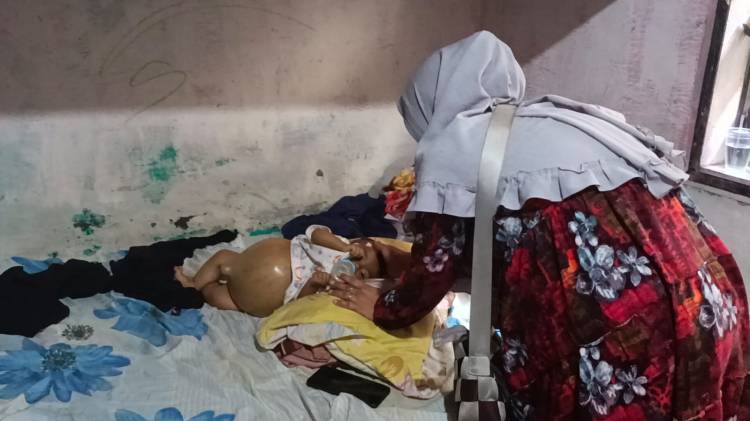 Bocah Penderita Atresia Biller Butuh Perhatian untuk Penyembuhan