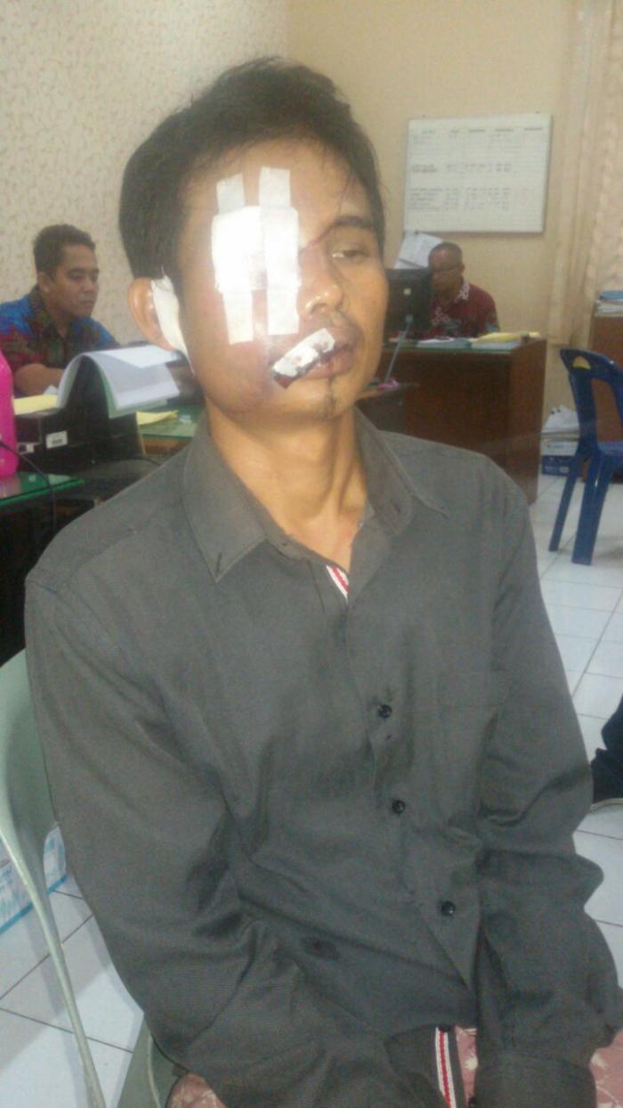 Beraksi di Warung Tuak, Mata Maling HP Ditutup, Bibir Diperban