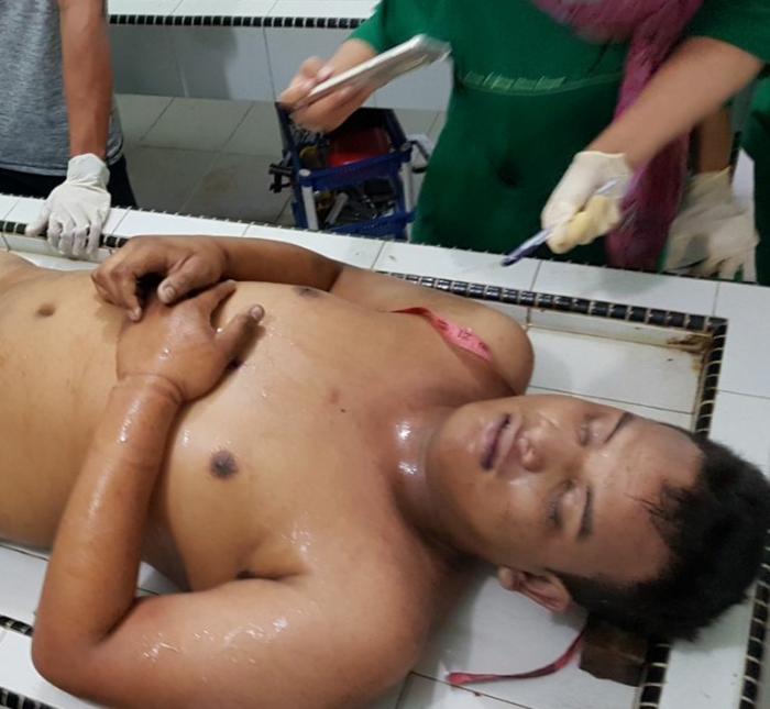 Polsek Medan Kota Tembak Mati Gembong Begal Medan