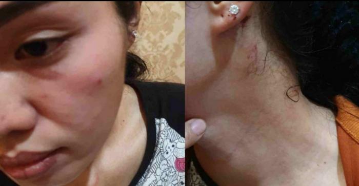 Ibu Hamil Kecewa, Kasus Penganiayaannya Berjalan Ditempat