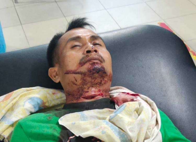 Diduga Gangguan Jiwa, Ayah Habisi Anak Kandung