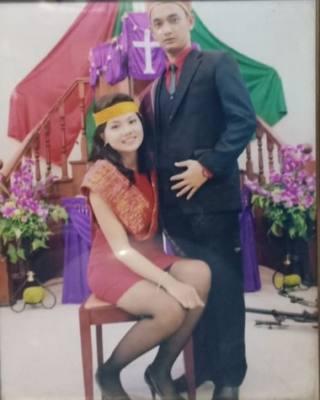 48 Hari Kritis, Mahasiswi Dibakar Mantan Pacar Akhirnya Meninggal